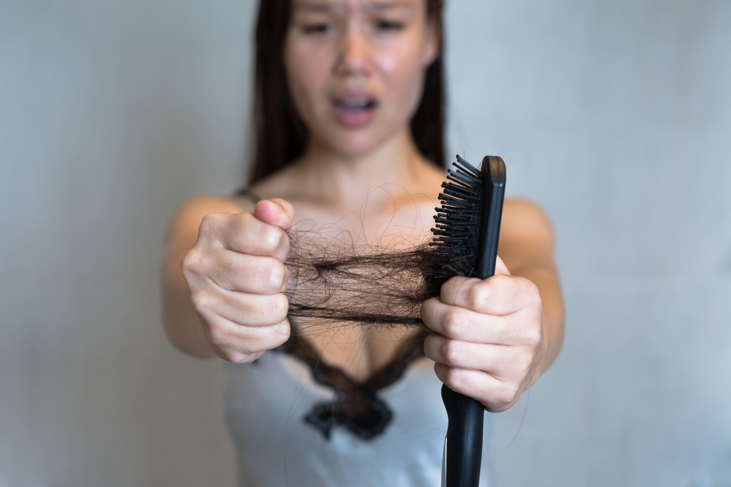 The Connection Between Hair Loss and Hormonal Changes