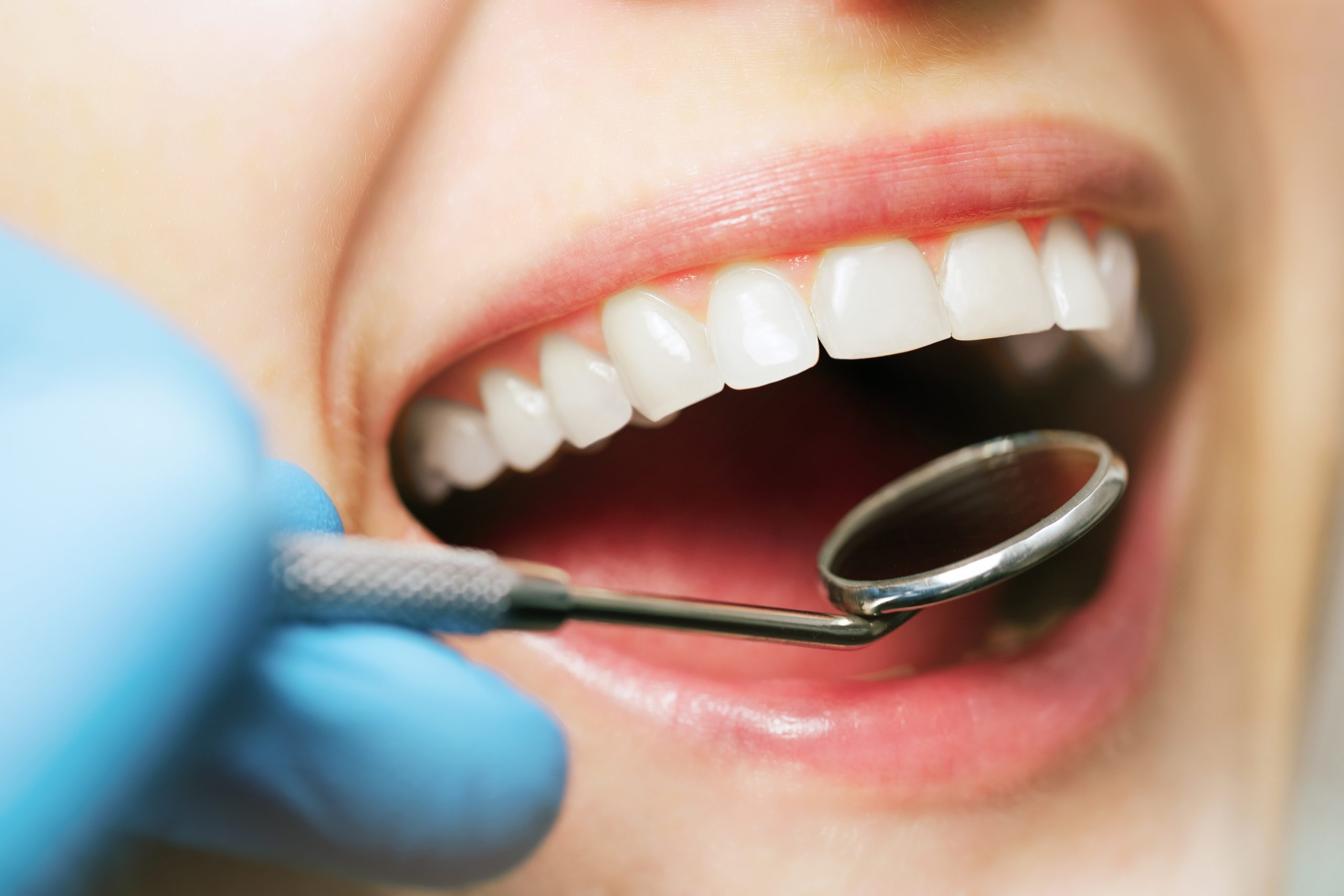 The benefits of regular dental checkups